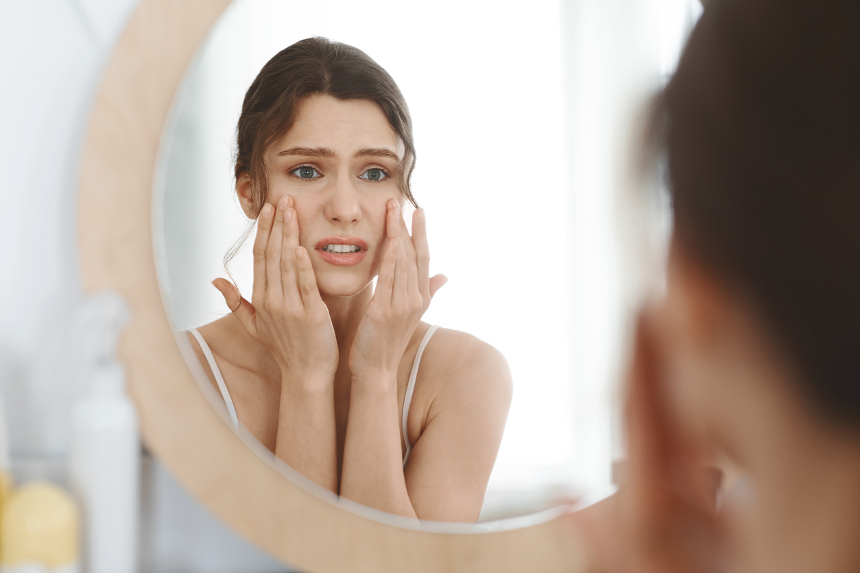 woman with stress acne observing her face in the mirror